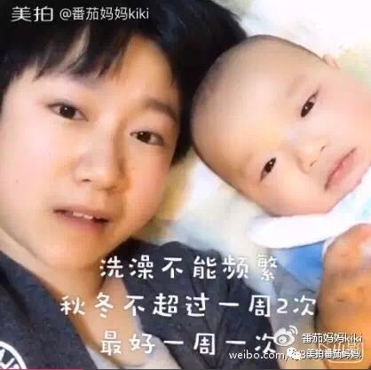 婴儿湿疹头垢洗了之后一直在出水,新生儿头垢和湿疹结痂的区别