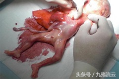 反复做人流对女性有哪些危害,女的做人流有什么不好