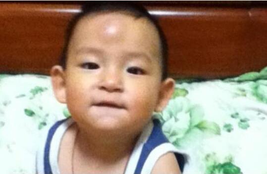 宝宝额头上的包越来越大,宝宝额头上的包变硬了