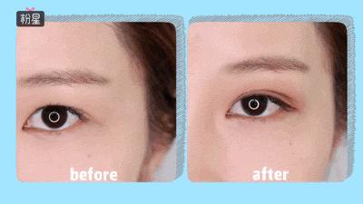 细长双眼皮贴小内双教程,最全双眼皮贴教程