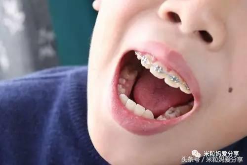 怕小孩吃不饱怎么办,宝宝吃软东西不会嚼怎么办