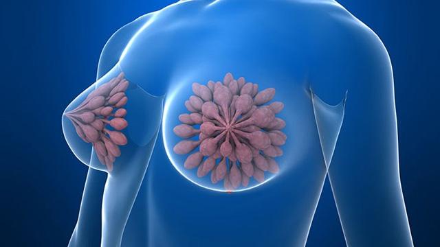 4种食物吃多了易诱发乳腺增生,大多数女生都有