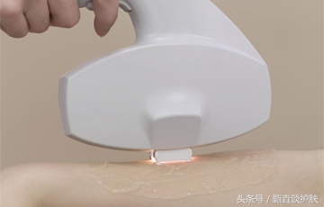 唇部脱毛哪种方式最好,脱毛哪种方法效果比较好呢