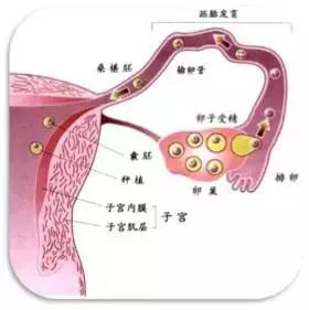 输卵管积水能移植吗,输卵管为什么会有积水