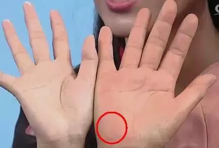 手上发紫中间发白,手上发紫发青还发痒是怎么回事