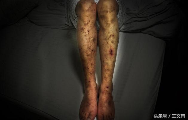 摆脱色粉,摆脱斑点和暗黄