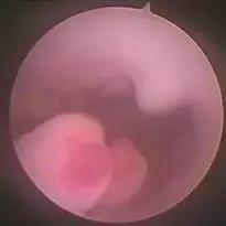 多年不孕的因果,多年不孕不育竟是妻子惹的祸