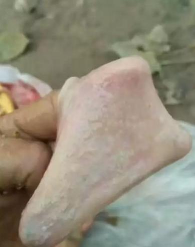 鸡霉菌的最佳防治方法,鸡绿脓杆菌病如何预防