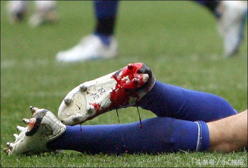足球场上令人毛骨悚然的受伤场面,足球受伤恐怖瞬间剪辑