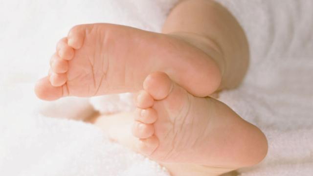 脚跟干裂不用怕，掌握这5个小方法，自己在家就能轻松预防