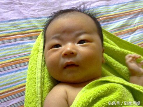 黄疸已经过了为什么还是偏黄,小孩皮肤偏黄会导致黄疸偏高吗