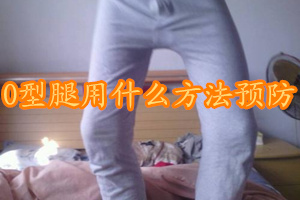 o型腿有什么快速的方法矫正,预防o型腿吃什么