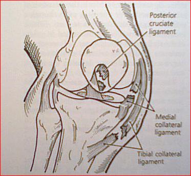 膝关节的急性损伤有哪些,膝关节侧韧带损伤症状