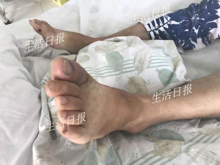 女子墙壁倒塌,围墙突然倒塌女子死里逃生