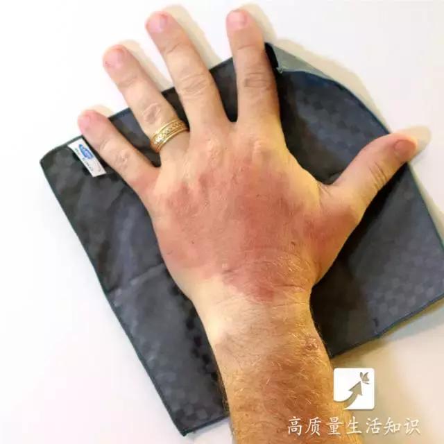 大人被开水烫伤怎么处理好得快,开水烫伤急救知识