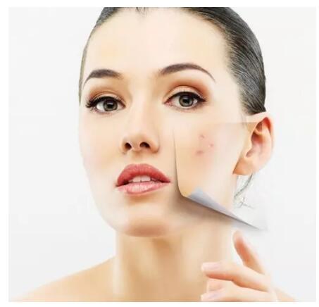 身体皮肤过敏后干燥起皮怎么修复,脸上过敏干痒红肿紧绷起皮涂什么