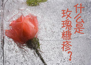 玫瑰糠疹名字挺好听，季节交替易感冒，小心它就黏上你