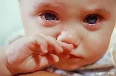 宝宝稍微受点凉就流鼻涕是鼻炎吗,天气转凉小孩子流鼻涕是不是正常