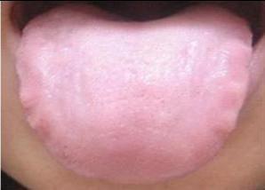 说话有气无力属于气虚吗,说话上气不接下气要怎么调理身体