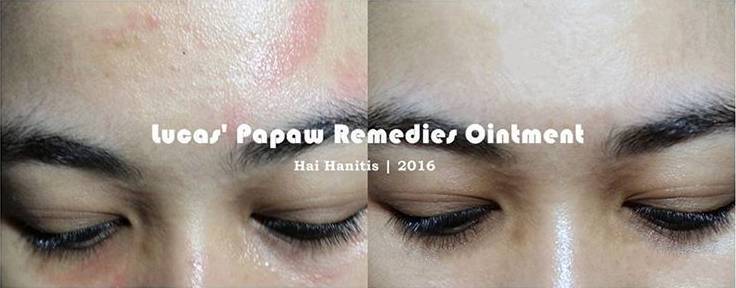 木瓜膏为什么这么神奇,澳洲木瓜膏都有哪些明星在用