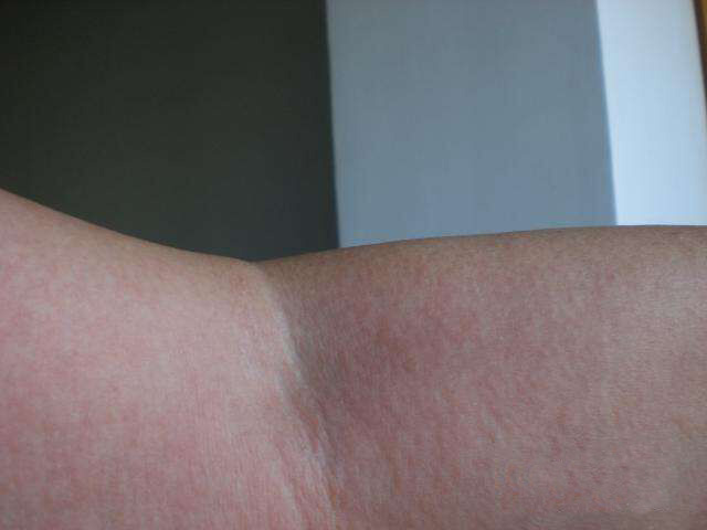 艾灰与白醋的功效与作用,艾灰不要扔了它也能治病