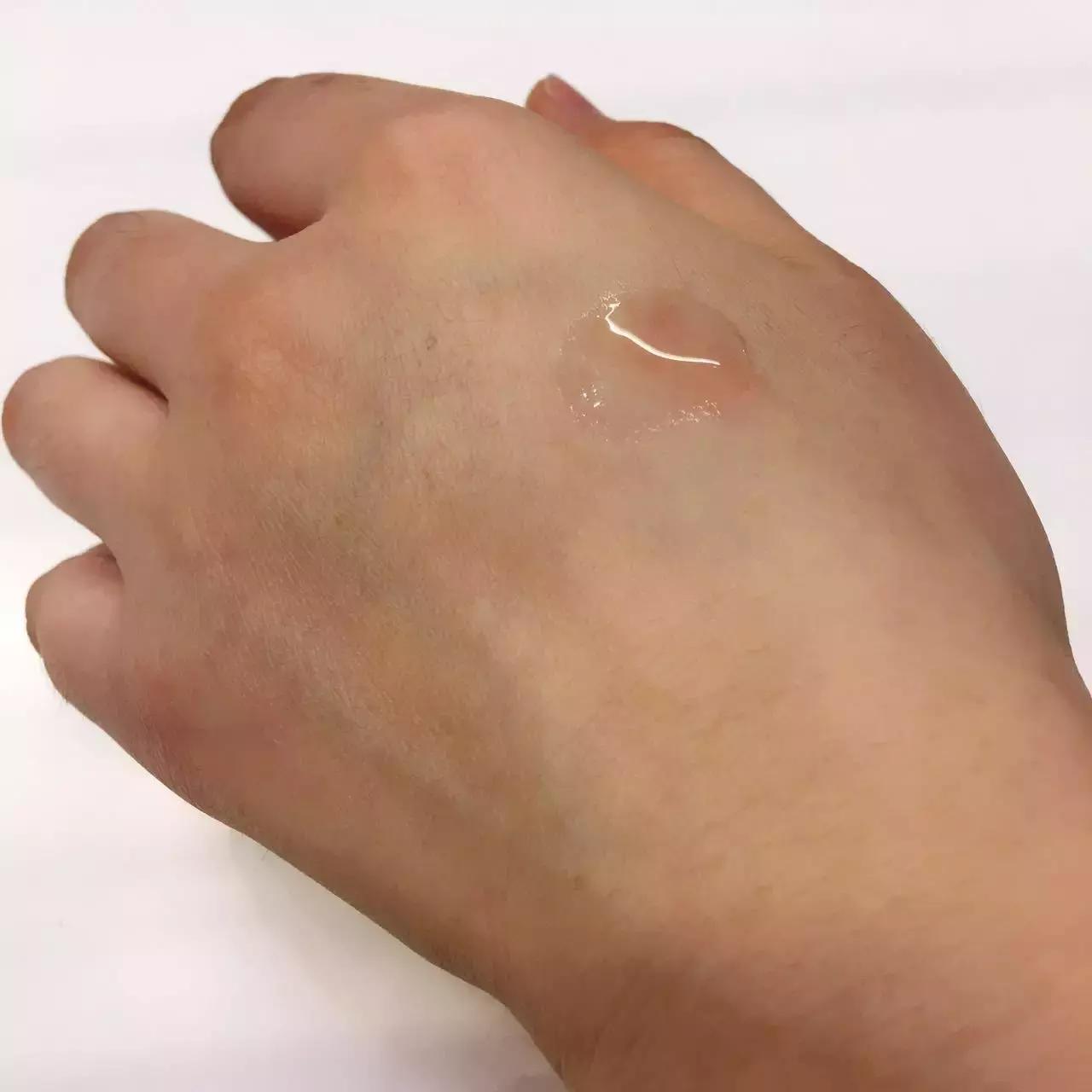 劲爆｜全球最牛X的5款玻尿酸大测评