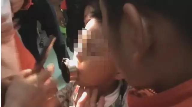 6岁宝宝喝水,不慎将舌头卡住瓶盖至血肿僵硬