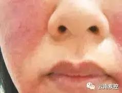 吃野生马蜂蛹违法吗,吃马蜂的蜂蛹中毒是什么原因