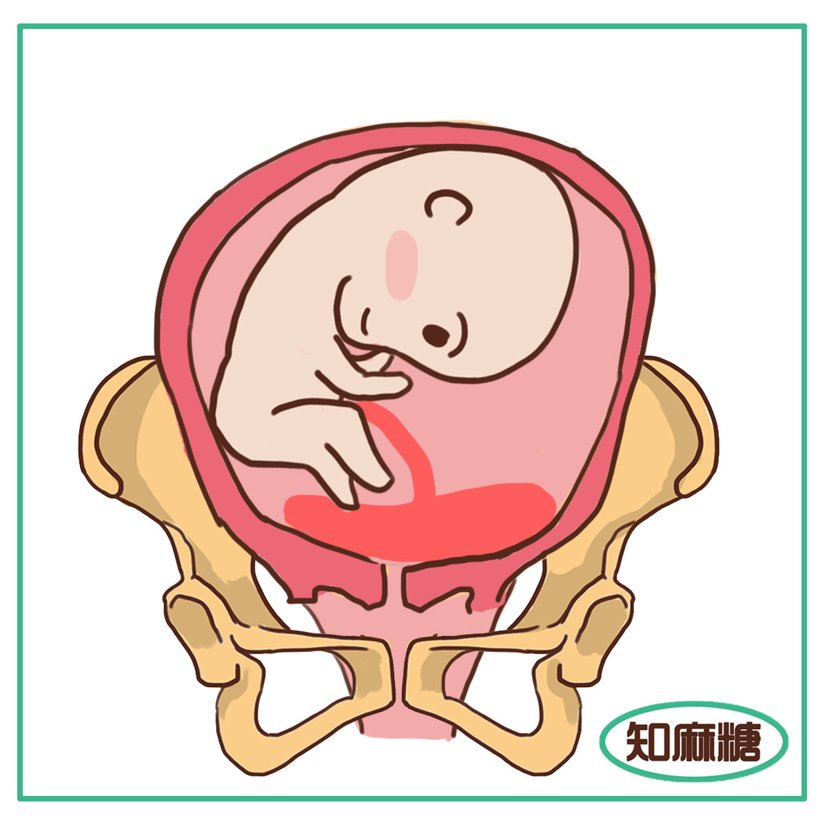 剖腹产必须知道的几件事,剖腹产一定要知道的事情