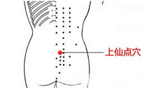 落枕腰疼手麻怎么缓解,落枕闪腰