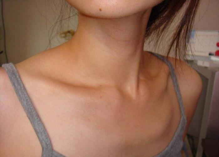 偏瘦的女生怎么瘦,女生怎么瘦才能瘦成功