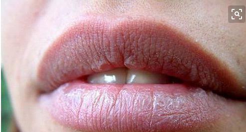 女人宫寒是不是也不易生女儿,女性宫寒莫大意