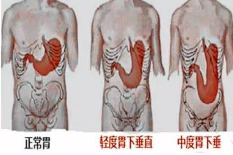 越瘦越容易得肺病,越瘦越容易得心脏病