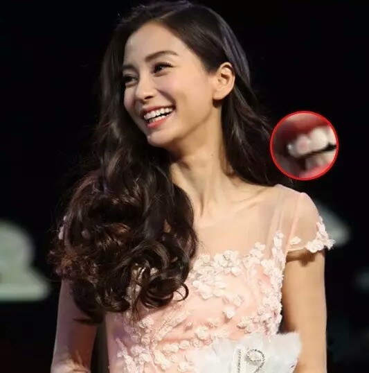 尴尬,你的口红沾到牙齿上了!