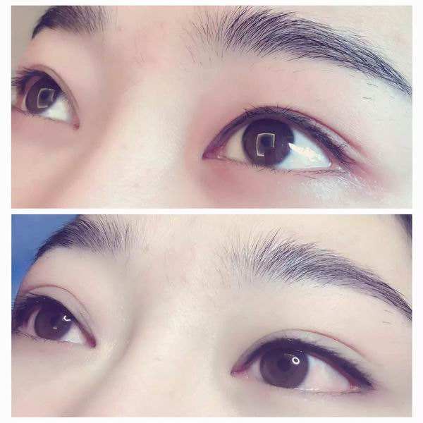 大部分人适合的美瞳,现在做美瞳的人多吗