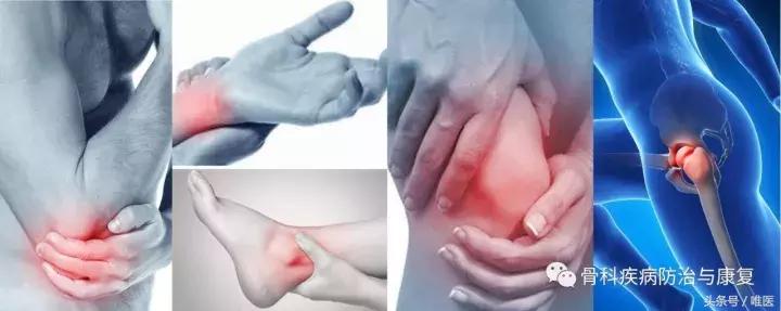 受寒骨关节炎,关节疼类风湿关节炎医学知识科普