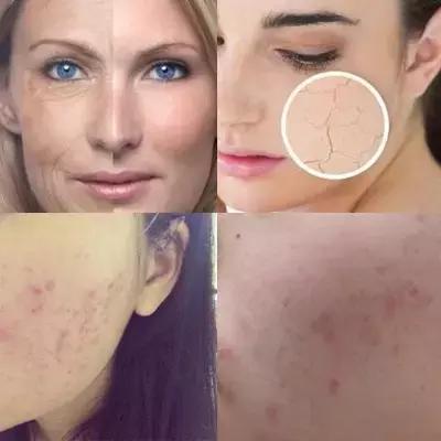 肌肤较干秋冬精华,秋冬不粘腻的精华水