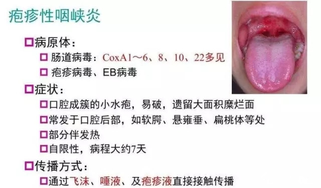 一周岁宝宝怎么预防口腔疾病,孩子的口腔健康要从小呵护