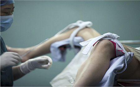 关于人工流产，这些是你们最关心的问题！