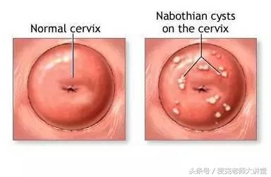 每个女人都应该做妇科检查,收藏女性都需知道的妇科检查知识
