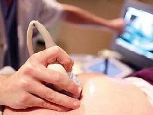 非常流行的肝硬度检查，乙肝患者为什么要做？