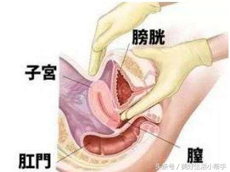 每次检查都让医生哭笑不得，内检简直有毒