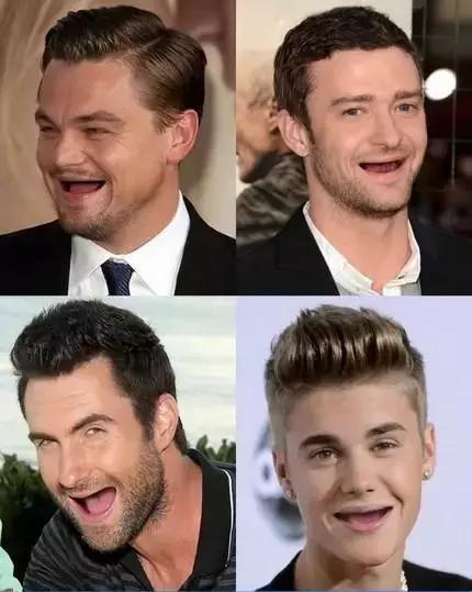 智齿导致旁边牙齿龋齿,智齿有龋齿有必要修补吗