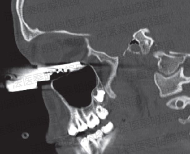 我们真的不想在假期开始前来一期重口味更新的