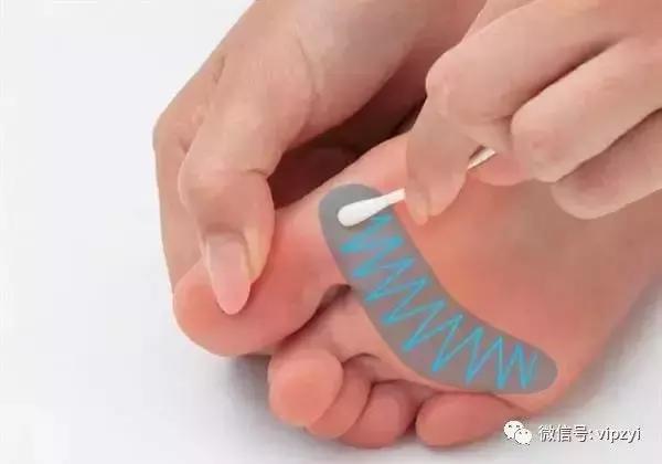 肩颈病的最好治疗方法,肩颈病最好的治疗方法