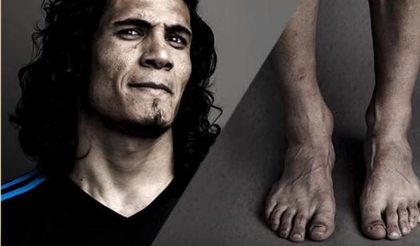 你知道足球长什么样子吗,足球球星的脚长什么样