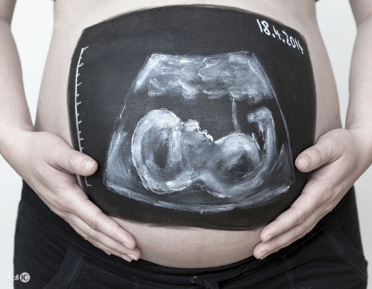 产检做b超要挂号吗,产检做b超正常还需要做胎监嘛