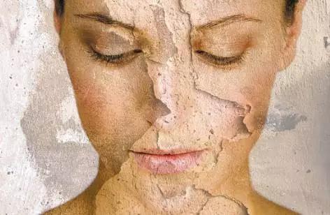 洗澡太勤长痘,长时间不洗后有鱼鳞