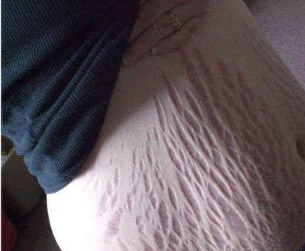 怀孕17周有什么症状及反应,怀孕16周会出现哪些症状