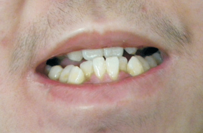 你的脸为什么会一边大一边小,新生儿的脸一边大一边小如何矫正